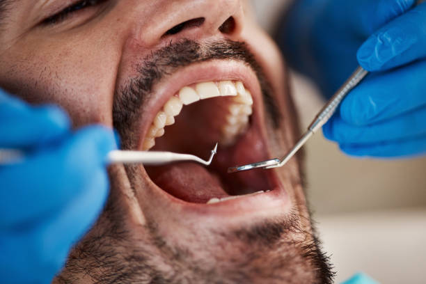 Best Emergency Treatment for Toothache in Quincy, CA