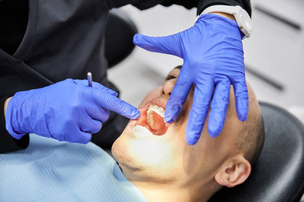 Best Emergency Tooth Extraction in Quincy, CA