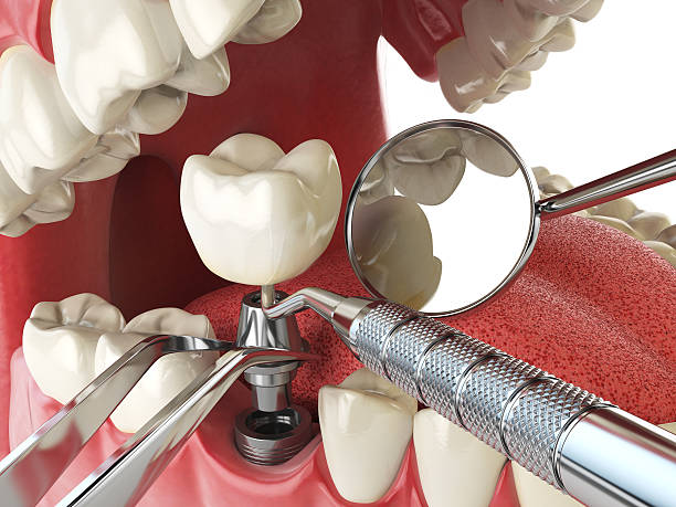 Best After-Hours Emergency Dentist in Quincy, CA