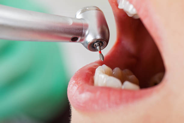Best Emergency Dental Surgery in Quincy, CA